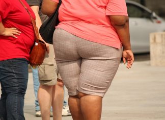 Is BBL Surgery Possible for Overweight Patients?