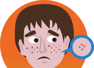 10 Strategies for Clearing Up Your Adult Acne