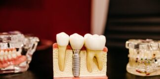 white and yellow wooden condiment shakers