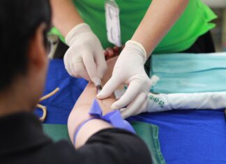 6 Tips to Improve the Quality of Your Healthcare Facility’s Services Free Person Getting His Blood Check Stock Photo