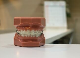 How the Face Changes After Braces – Nose, Lips, Chin