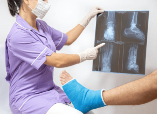 Common Car Accident Injuries That Deserve Compensation