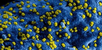 yellow flower petals on blue textile