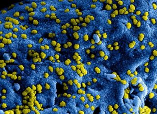 yellow flower petals on blue textile