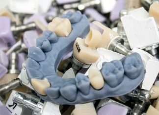 Why Quality Crown and Bridge Products Matter for Dental Success a close up of a dental model on a table
