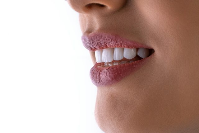 Photo by Kamal Hoseinianzade a close up of a woman's mouth with white teeth