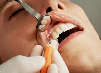 5 Quick Smile Upgrades with Dental Veneers in Edison