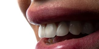 a close-up of a person's mouth with teeth showing