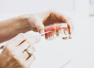 Questions Worth Asking Before You Commit to Full-Arch Dental Implants person wearing silver-colored ring while holding denture