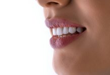 Cosmetic Dentistry and the Psychology of a Smile Makeover: What Porcelain Veneers Really Change a close up of a woman's mouth with white teeth