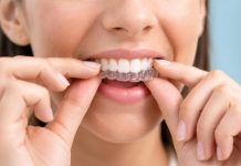 Why Adults Are Choosing Clear Aligners Over Braces: A Practical Guide for Busy Professionals Woman adjusting clear dental aligners on teeth