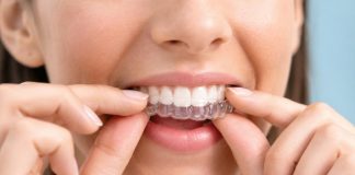 Woman adjusting clear dental aligners on teeth
