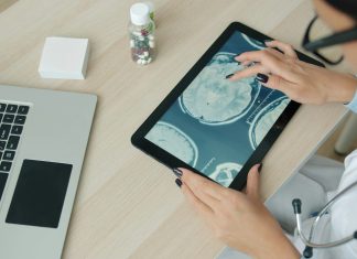 Why Your Patient Records Still Don’t Talk to Each Other Doctor examining brain scan on tablet at desk